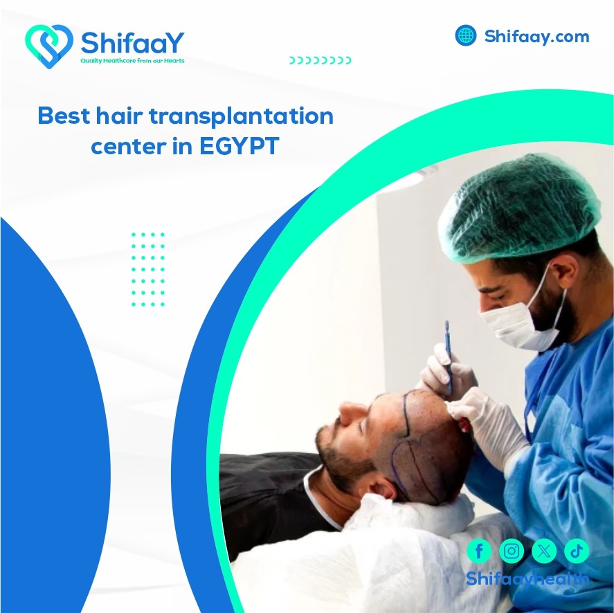 The best place for hair transplantation in Egypt