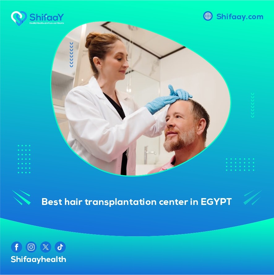 The best place for hair transplantation in Egypt