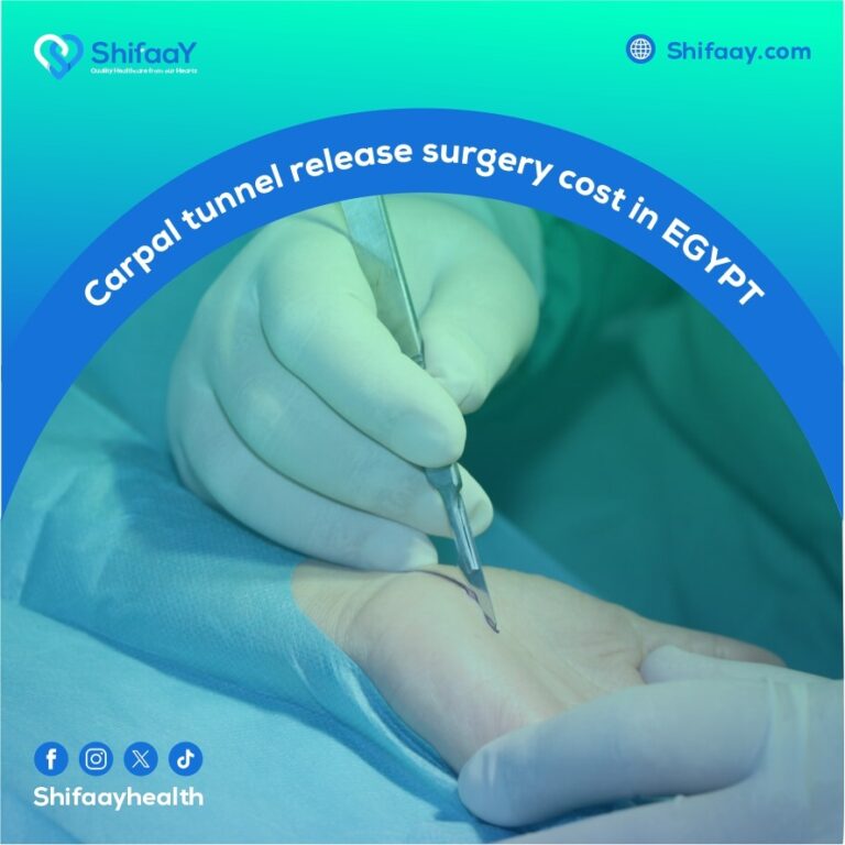 The cost of carpal tunnel release surgery in Egypt