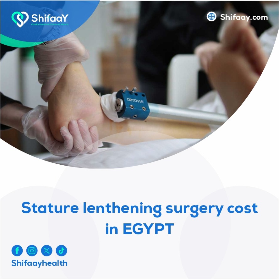 The price of height lengthening surgery in Egypt