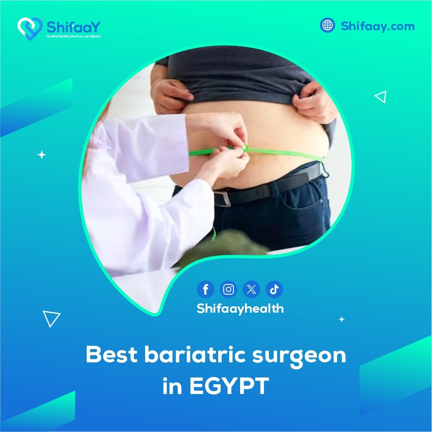 The best bariatric surgeon in Egypt