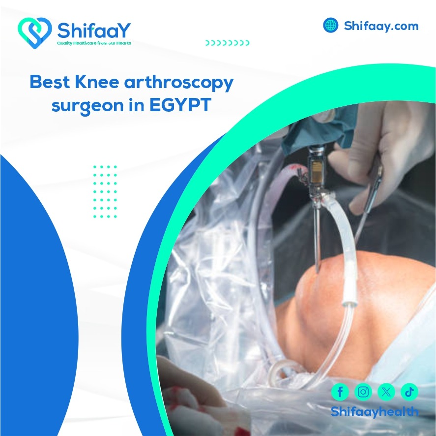 The best knee arthroscopic surgeon in Egypt