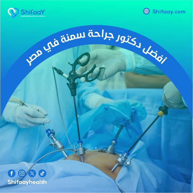 أفضل دكتور جراحة سمنة في مصر