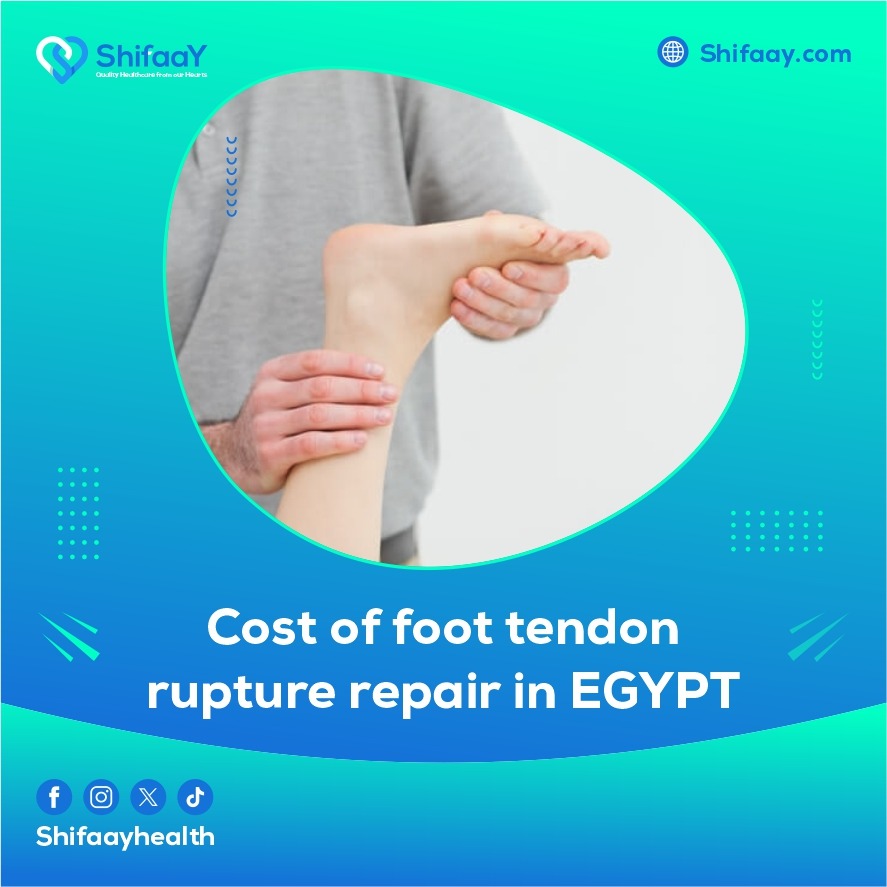 The cost of leg tendon repair surgery in Egypt