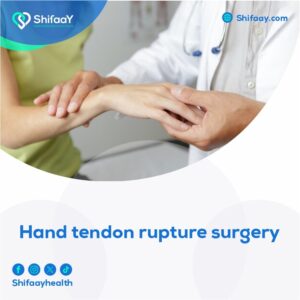 The cost of hand tendon repair surgery - Shifaay