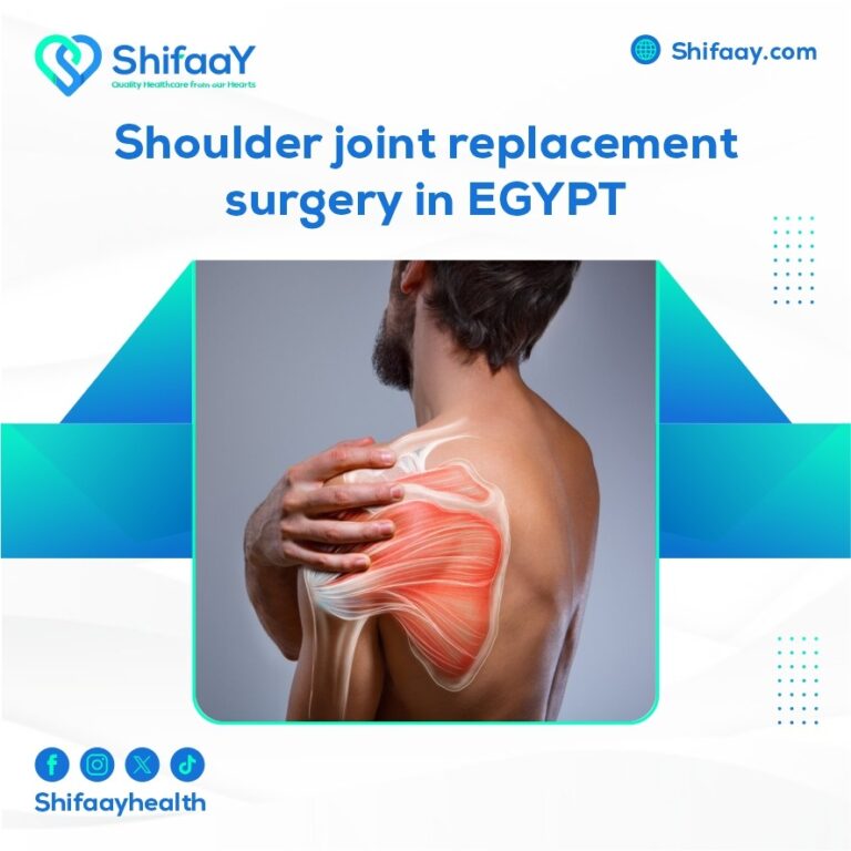 shoulder joint replacement surgery in egypt