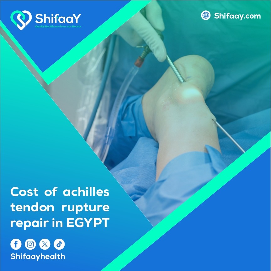 he cost of Achilles tendon rupture surgery in Egypt