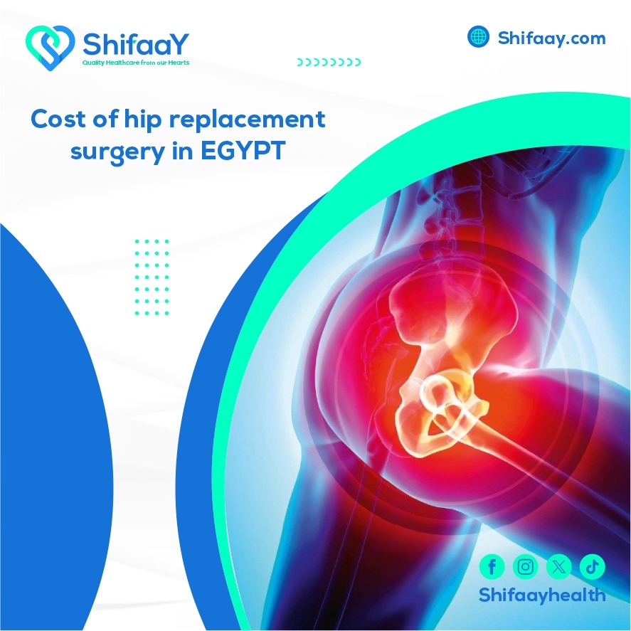 the cost of hip joint replacement surgery in Egypt