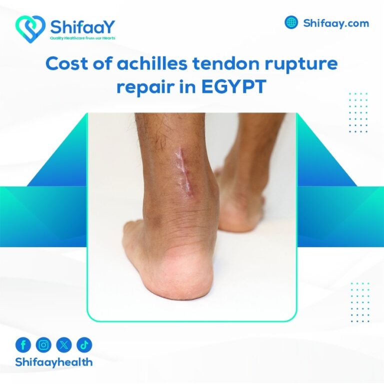 The cost of Achilles tendon rupture surgery