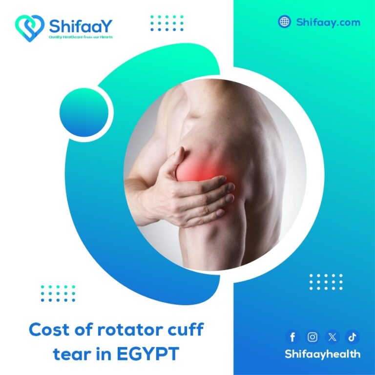 The cost of shoulder tendon rupture surgery in Egypt - Shifaay