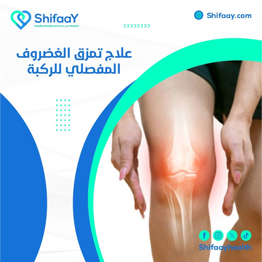 علاج تمزق الغضروف المفصلي للركبة