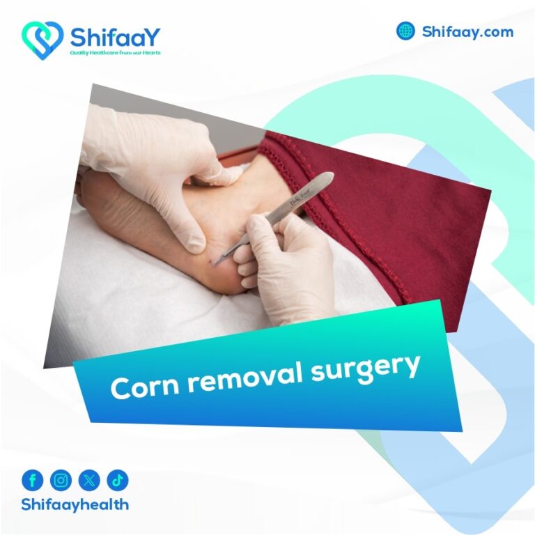 Callus removal surgery (Corn removal surgery)