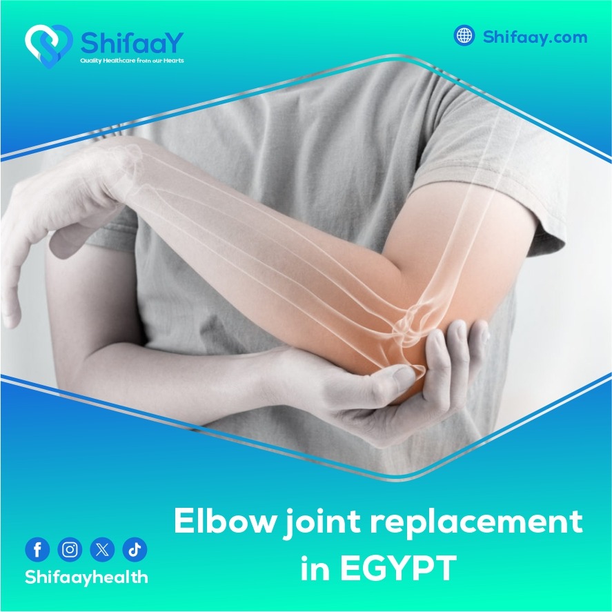  Elbow joint replacement surgery in egypt