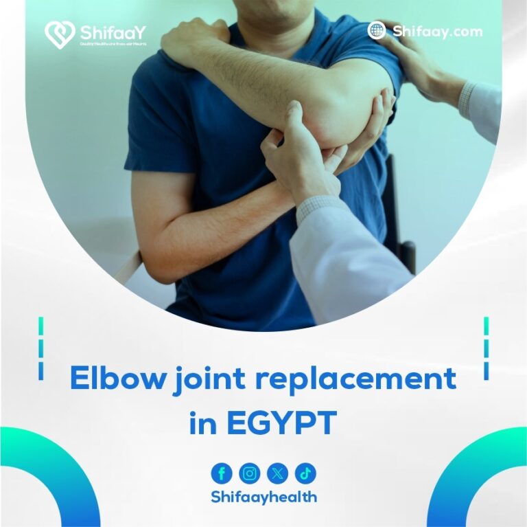 Elbow joint replacement surgery in egypt