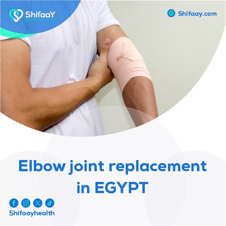  Elbow joint replacement surgery in egypt