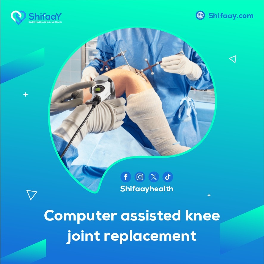Computer assisted knee joint replacement technique