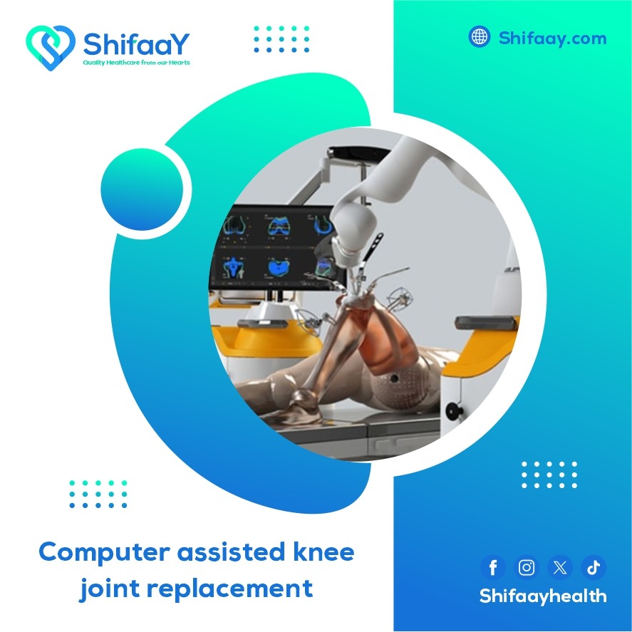 Computer assisted knee joint replacement technique