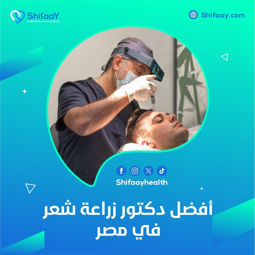 افضل دكتور زراعة شعر في مصر