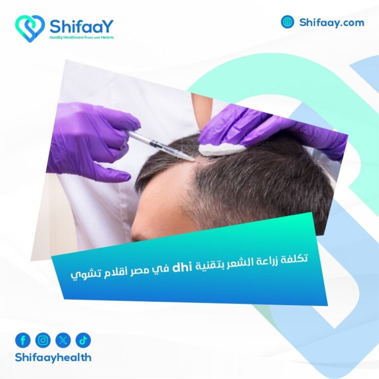 تكلفة زراعة الشعر بتقنية dhi في مصر أقلام تشوي