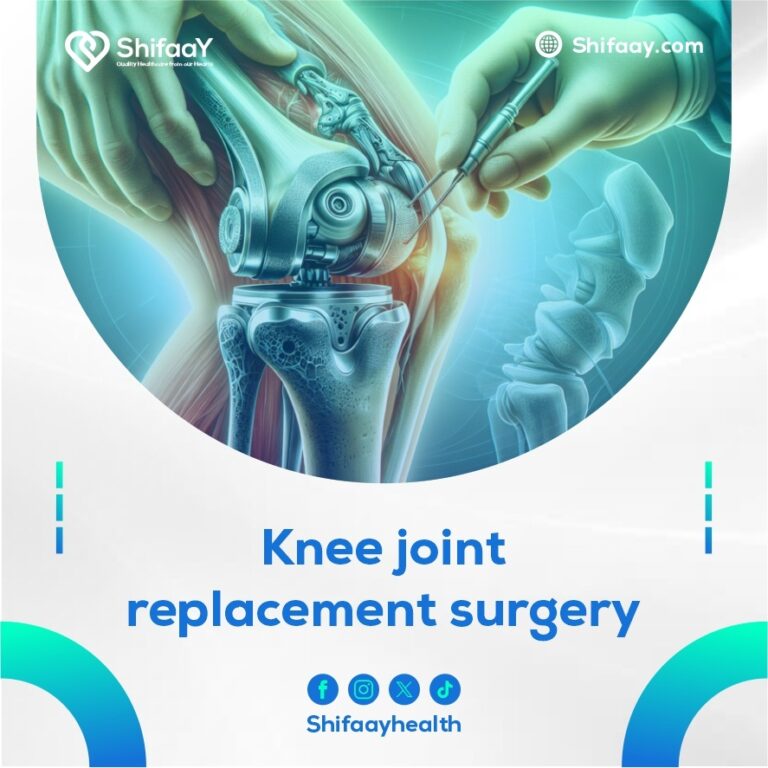 Knee joint replacement surgery