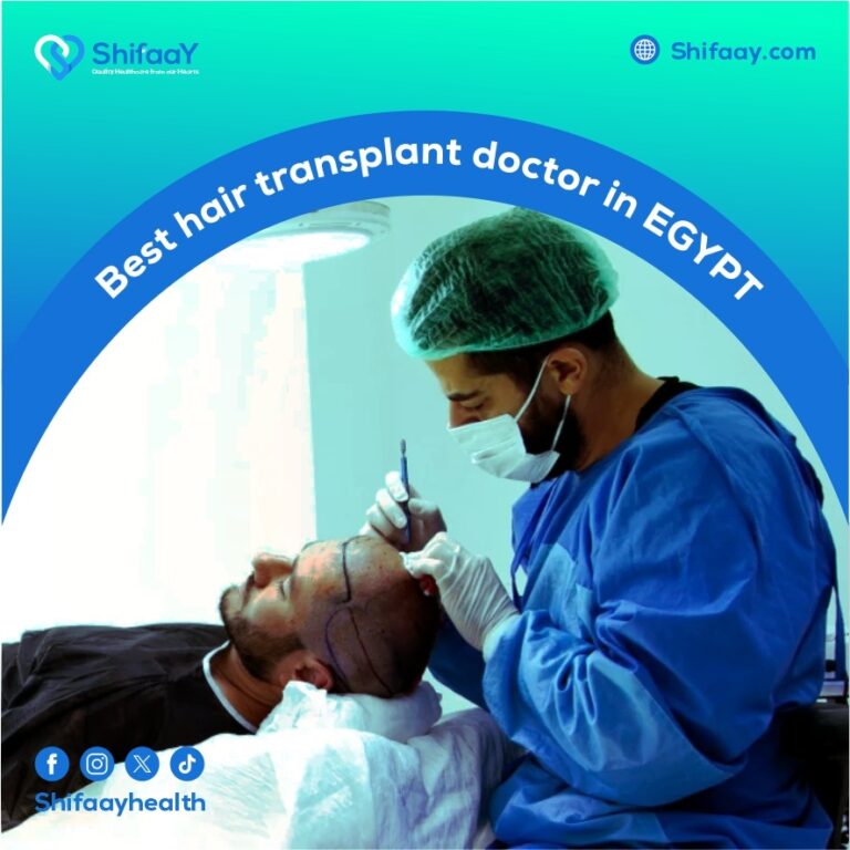 The best hair transplant doctor in Egypt