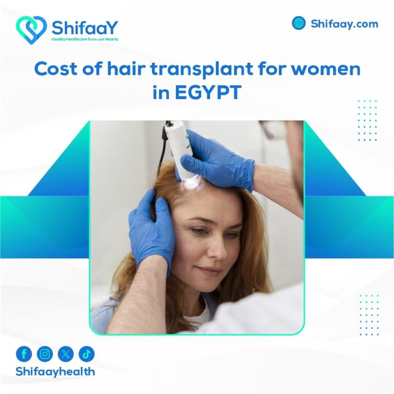 The cost of hair transplantation for women in Egypt