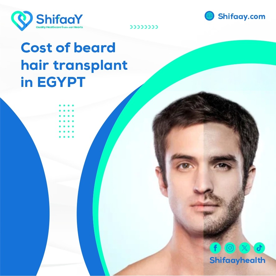 The cost of beard hair transplantation in Egypt