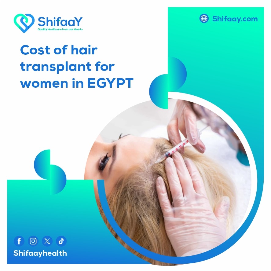 The cost of hair transplantation for women in Egypt