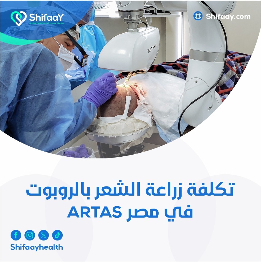 تكلفة زراعة الشعر بالروبوت في مصر artas