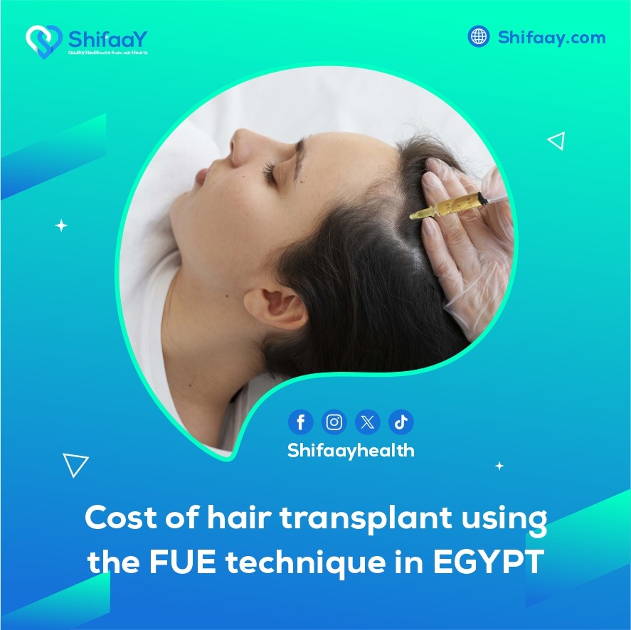 The cost of FUE hair transplantation in Egypt