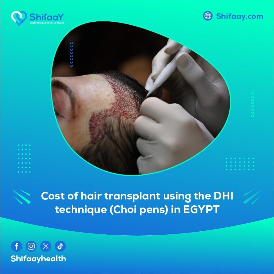 hair transplantation using the DHI