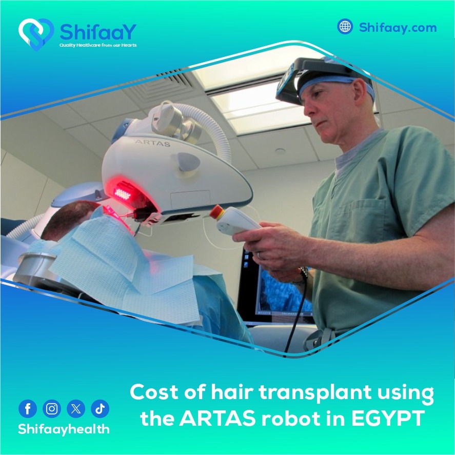 The cost of robotic hair transplantation in Egypt ARTAS