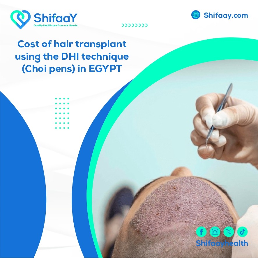 hair transplantation using the DHI