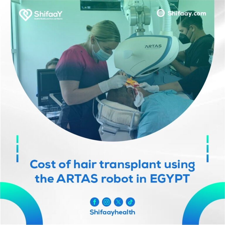 The cost of robotic hair transplantation in Egypt ARTAS