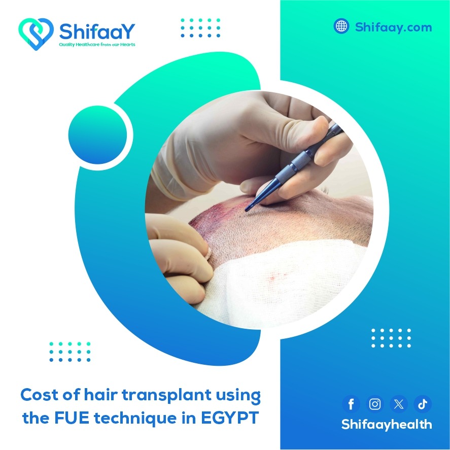 The cost of FUE hair transplantation in Egypt