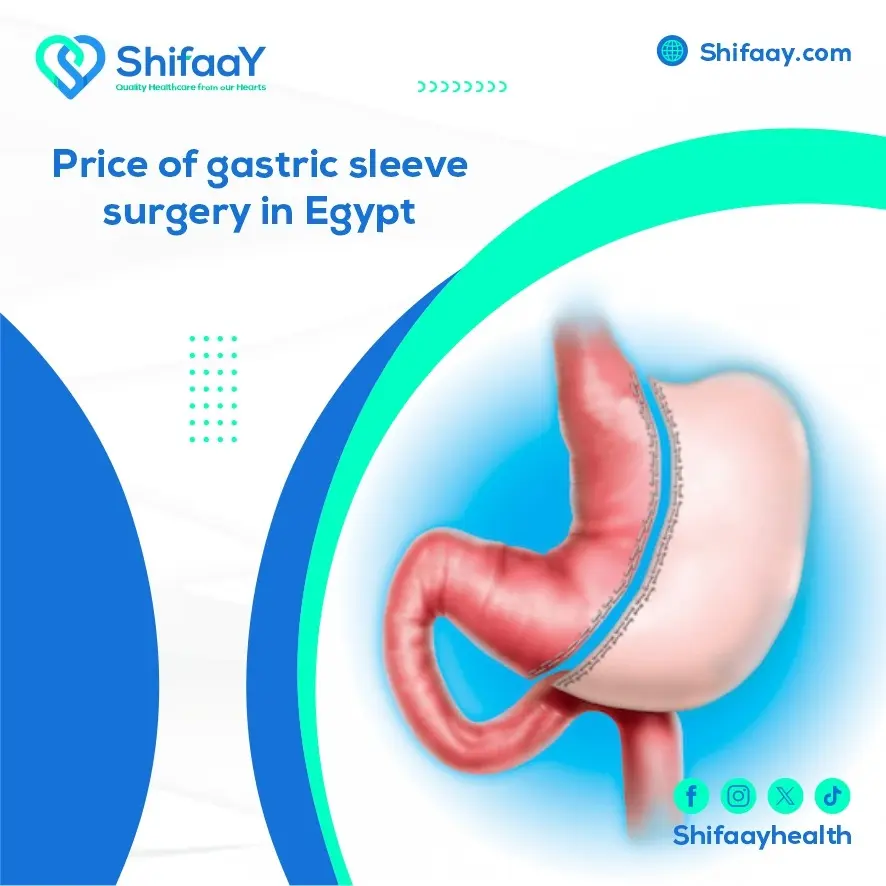 Gastric Sleeve Surgery Cost in Egypt 2 Gastric Sleeve Surgery
