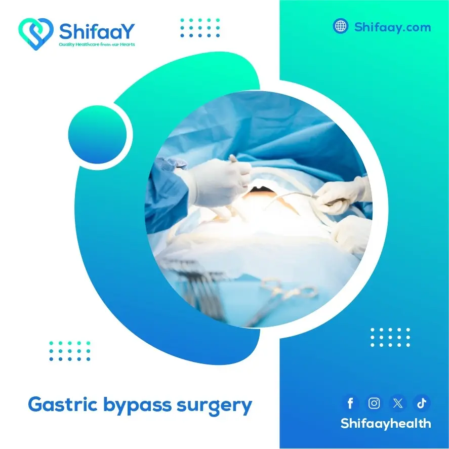 Gastric Bypass Surgery 1 Gastric Bypass Surgery