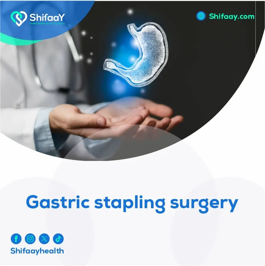 Gastric Stapling Surgery 2 Gastric Stapling Surgery