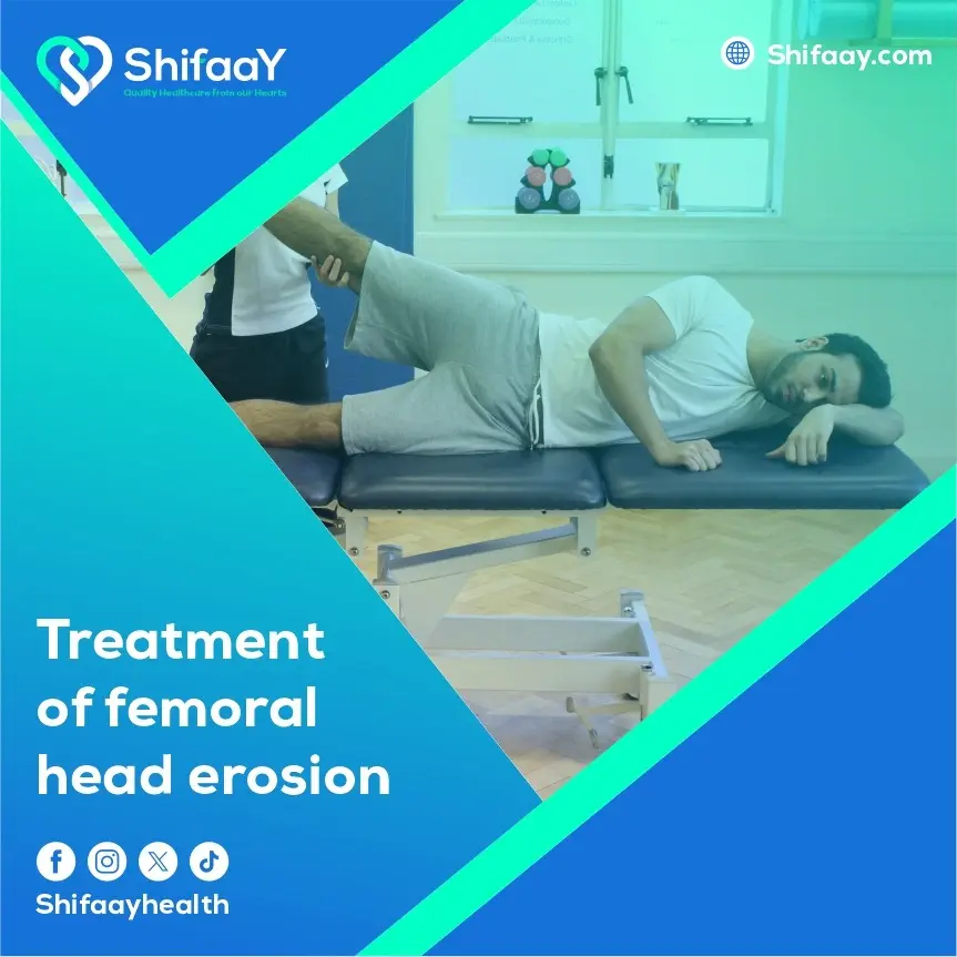 Treatment of Femoral Head Erosion 2 Femoral Head Erosion