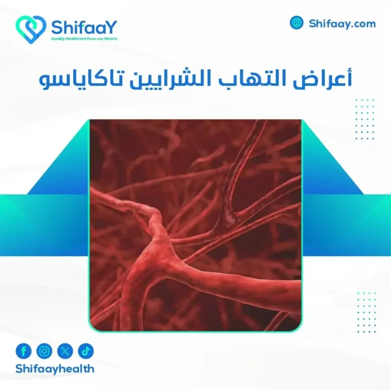 أعراض التهاب الشرايين تاكاياسو