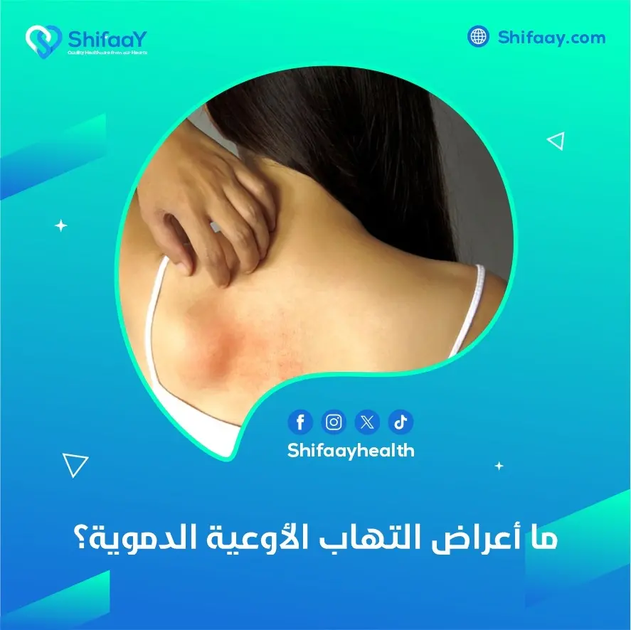أعراض التهاب الأوعية الدموية وعلاجها 2 التهاب الأوعية الدموية