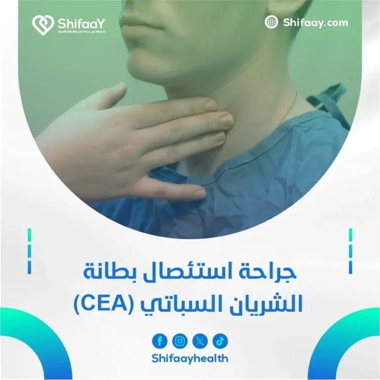 جراحة استئصال بطانة الشريان السباتي (CEA)