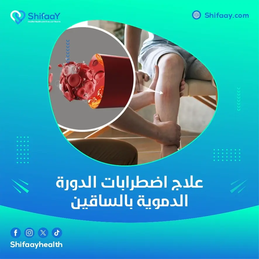 علاج اضطرابات الدورة الدموية بالساقين 2 علاج اضطرابات الدورة الدموية بالساقين