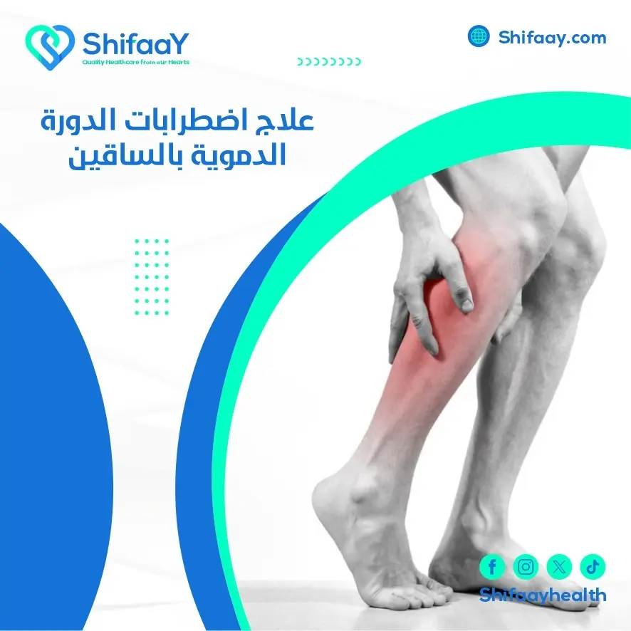 علاج اضطرابات الدورة الدموية بالساقين 1 علاج اضطرابات الدورة الدموية بالساقين