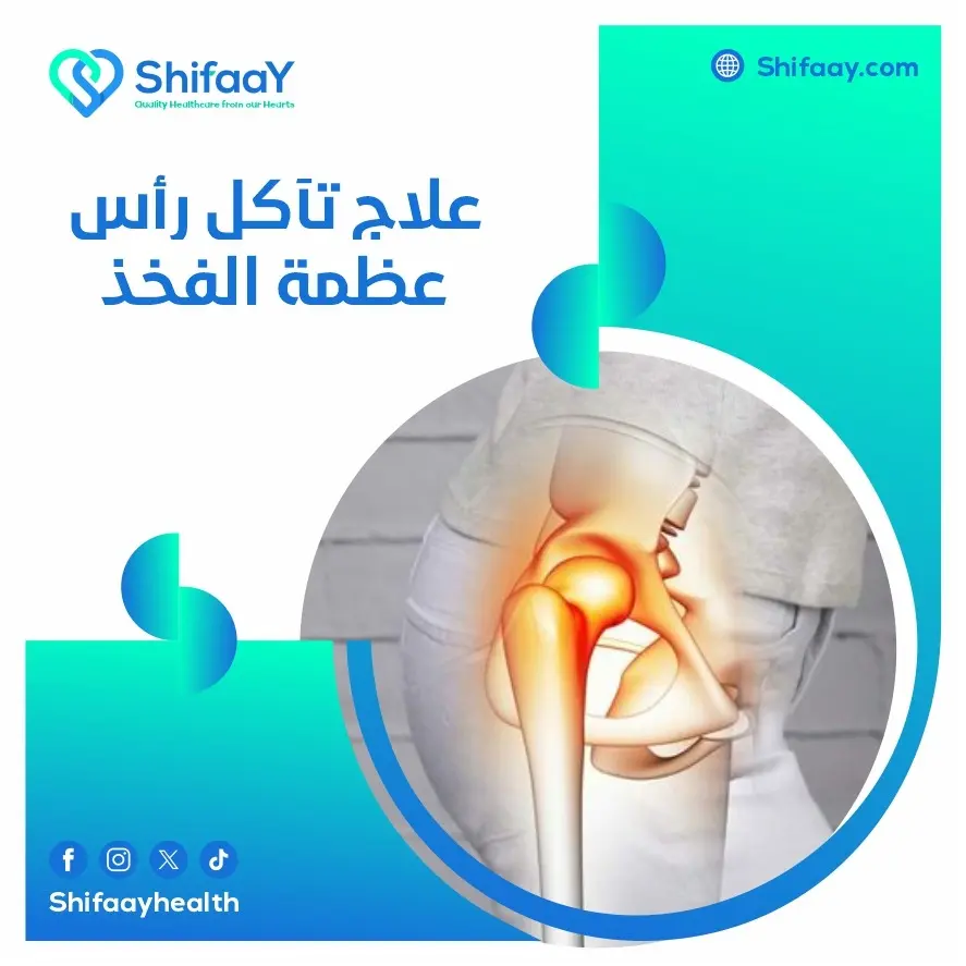 علاج تآكل رأس عظمة الفخذ 1 علاج تآكل رأس عظمة الفخذ