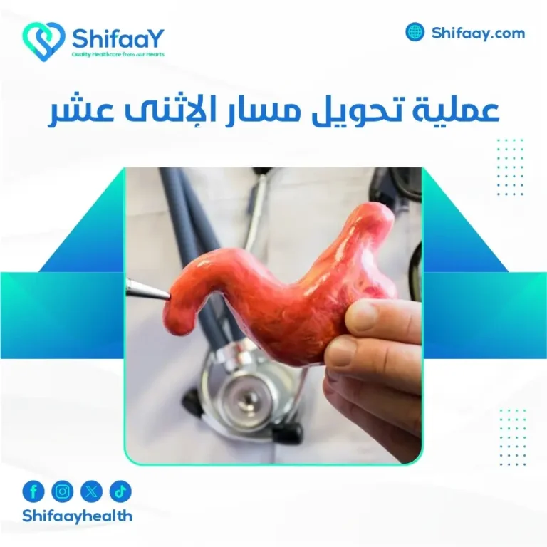 عملية تحويل مسار الإثنى عشر