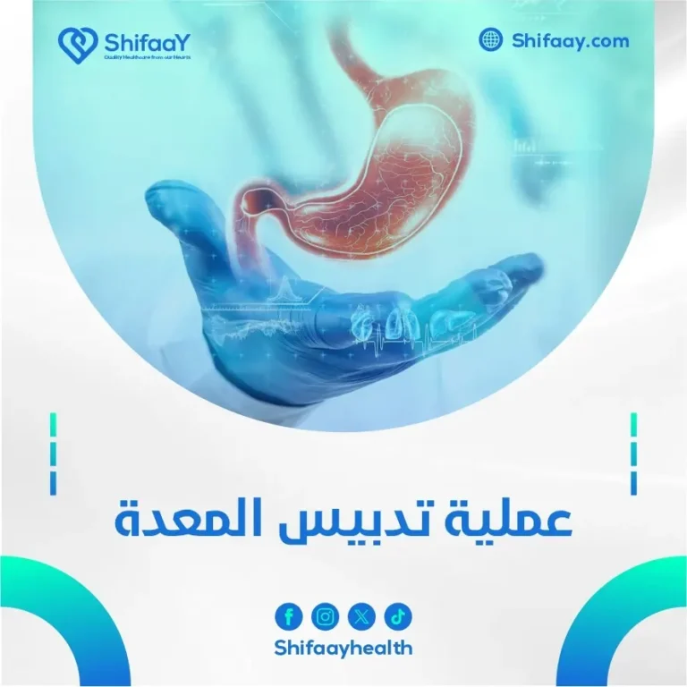 عملية تدبيس المعدة