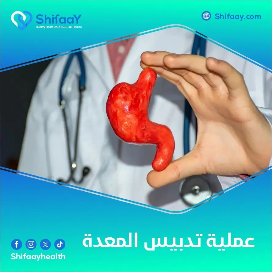 عملية تدبيس المعدة 1 عملية تدبيس المعدة