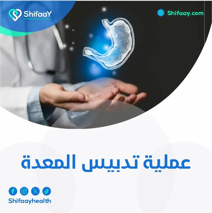 عملية تدبيس المعدة 2 عملية تدبيس المعدة