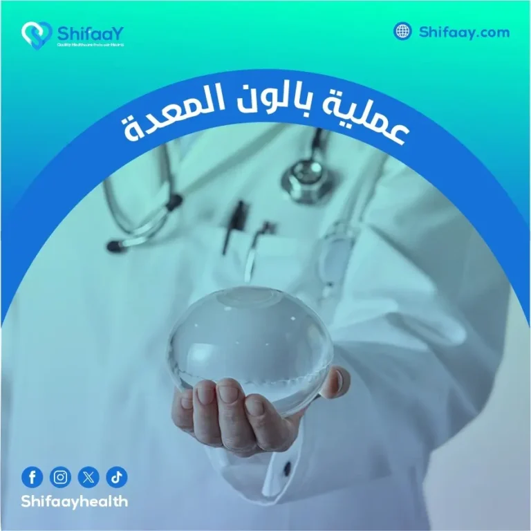 ما هي عملية بالون المعدة